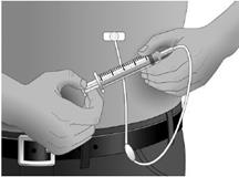If the needle was not inserted properly, repeat the priming and insertion of the needle