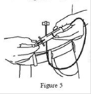 Figure 5 shows you how to determine if you inserted the needle properly.