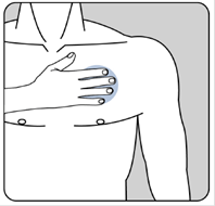 Notice Patient Rivastigmine Arrow Mg Heures Dispositif Transdermique Base De Donn Es