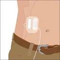AG_Infuse_A-01 600