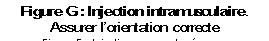 Figure G : Injection intramusculaire. 
Assurer l’orientation correcte  de l’aiguille
