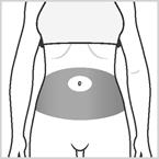 Injection_site_request_FEB_2018_Page_1