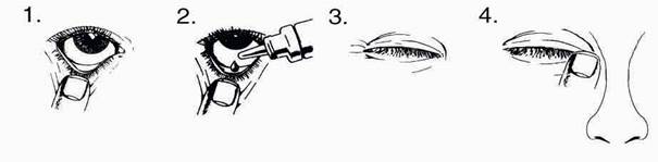 Combigan-4%20pictures