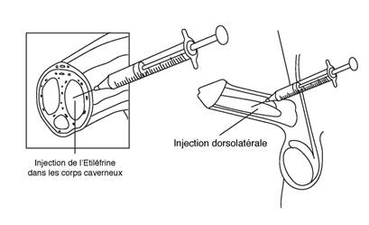 Schémas Etiléfrine 2