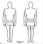 Figure 2 shows you the body sites to chose to inject XEMBIFY.